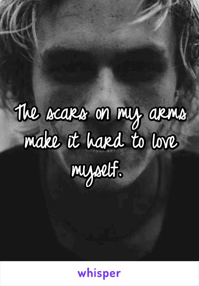 The scars on my arms make it hard to love myself. 