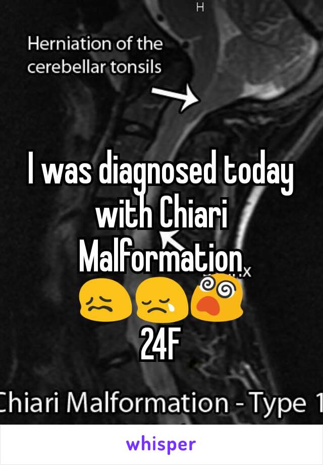 I was diagnosed today with Chiari Malformation
😖😢😵
24F