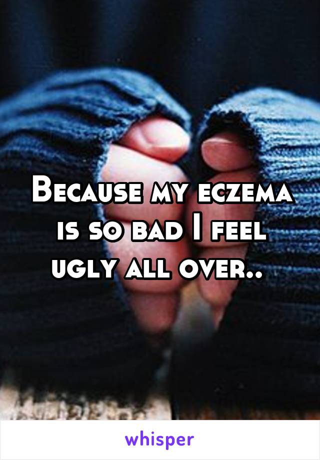 Because my eczema is so bad I feel ugly all over.. 