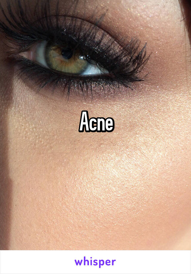 Acne
