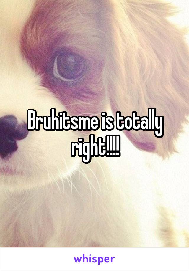 Bruhitsme is totally right!!!!