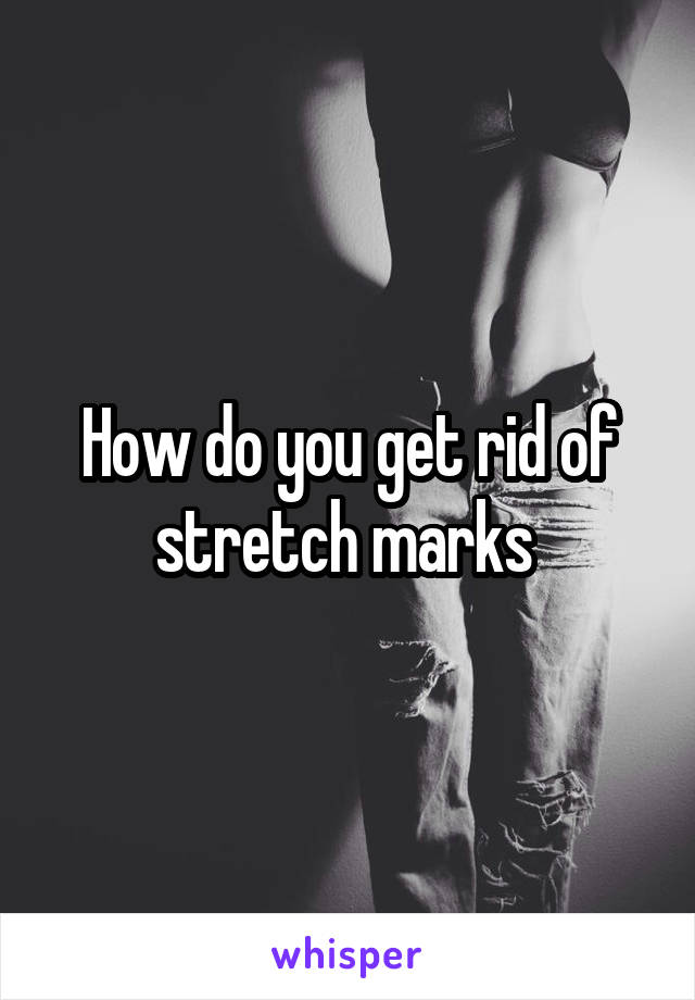 How do you get rid of stretch marks 