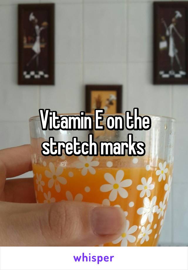 Vitamin E on the stretch marks 