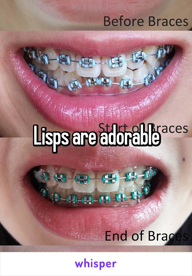 Lisps are adorable