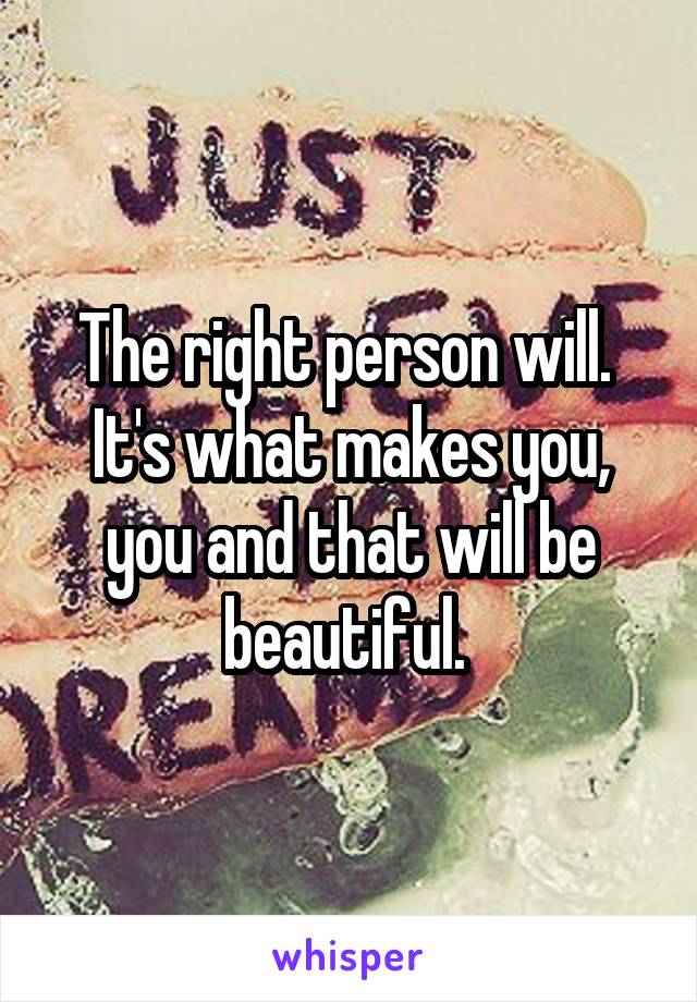 The right person will. 
It's what makes you, you and that will be beautiful. 