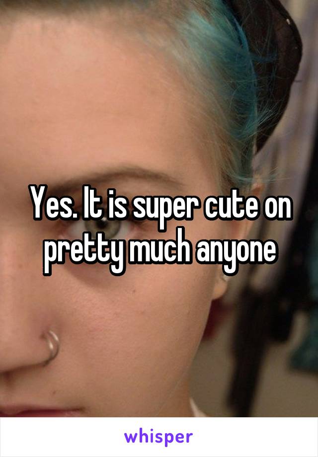 Yes. It is super cute on pretty much anyone