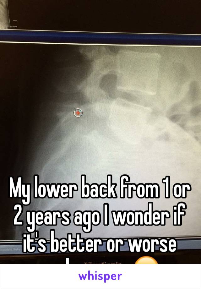 





My lower back from 1 or 2 years ago I wonder if it's better or worse prob worse 😂