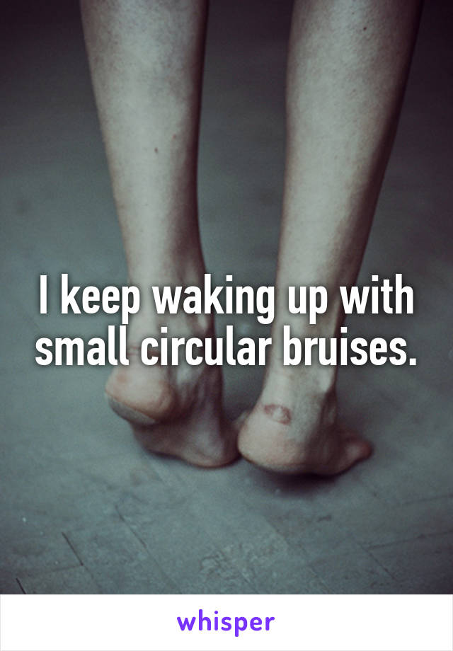 I keep waking up with small circular bruises.