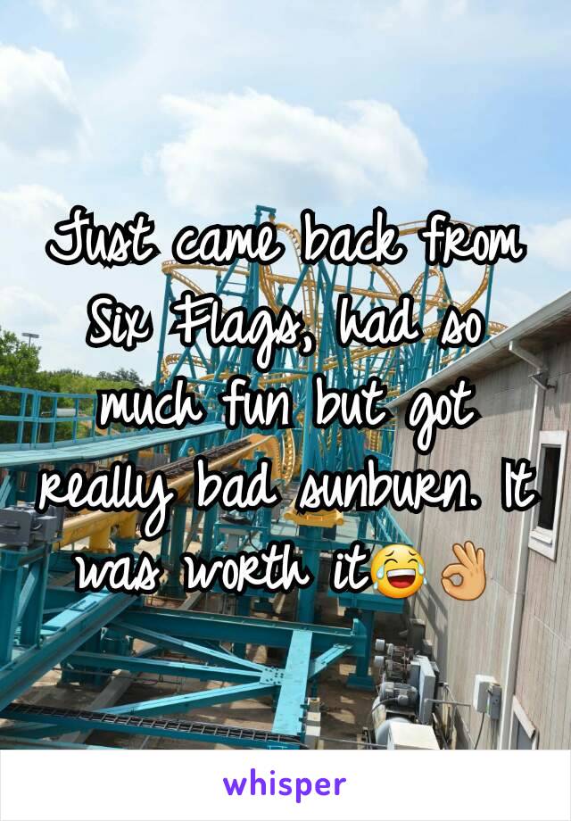 Just came back from Six Flags, had so much fun but got really bad sunburn. It was worth it😂👌