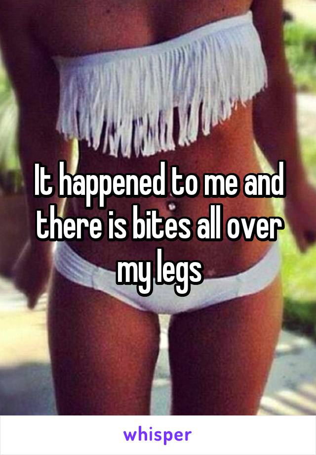 It happened to me and there is bites all over my legs