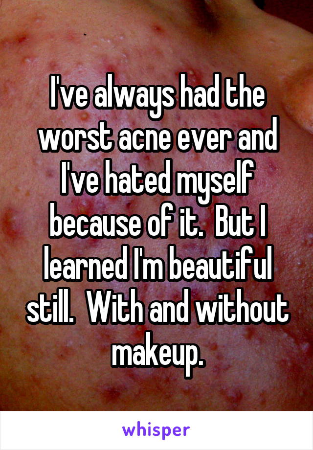 I've always had the worst acne ever and I've hated myself because of it.  But I learned I'm beautiful still.  With and without makeup.