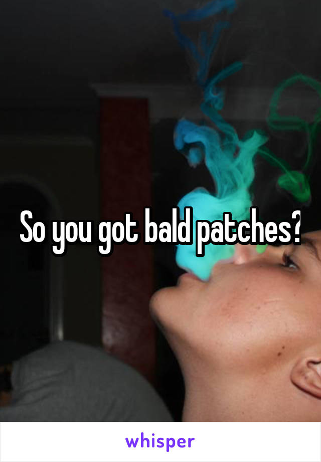 So you got bald patches?