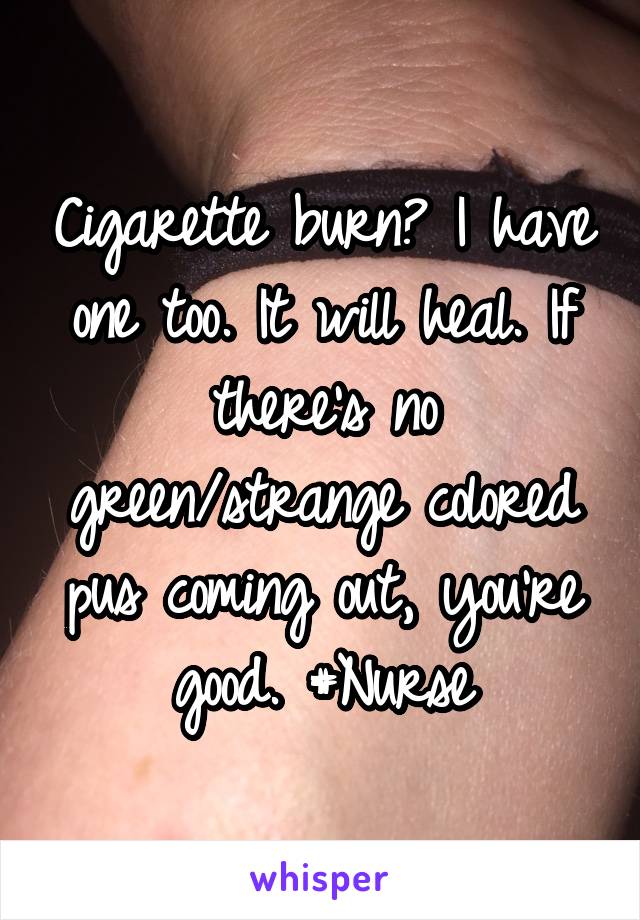 Cigarette burn? I have one too. It will heal. If there's no green/strange colored pus coming out, you're good. #Nurse