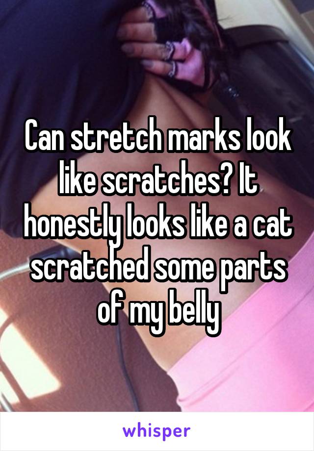 Can stretch marks look like scratches? It honestly looks like a cat scratched some parts of my belly