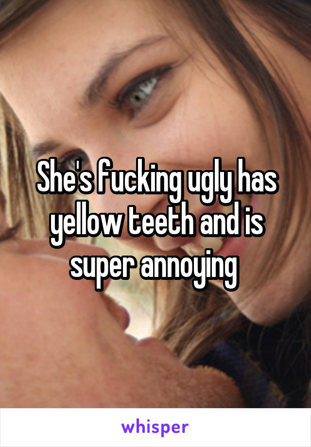 She's fucking ugly has yellow teeth and is super annoying 