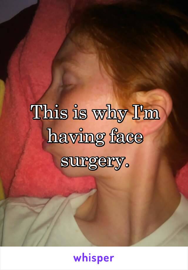 This is why I'm having face surgery.