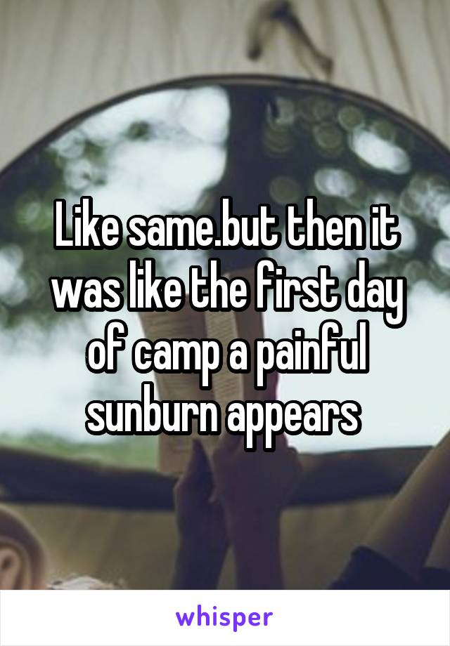 Like same.but then it was like the first day of camp a painful sunburn appears 