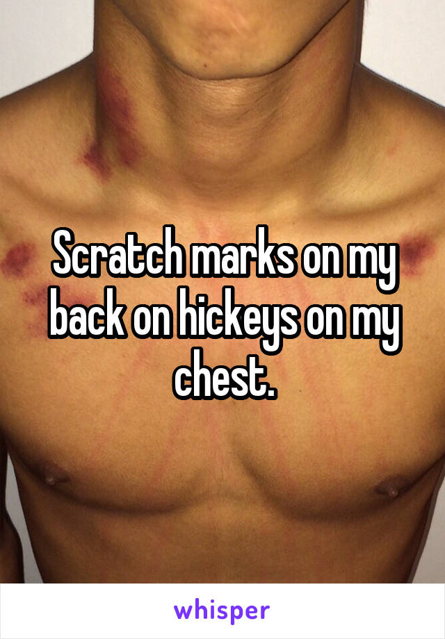 Scratch marks on my back on hickeys on my chest.