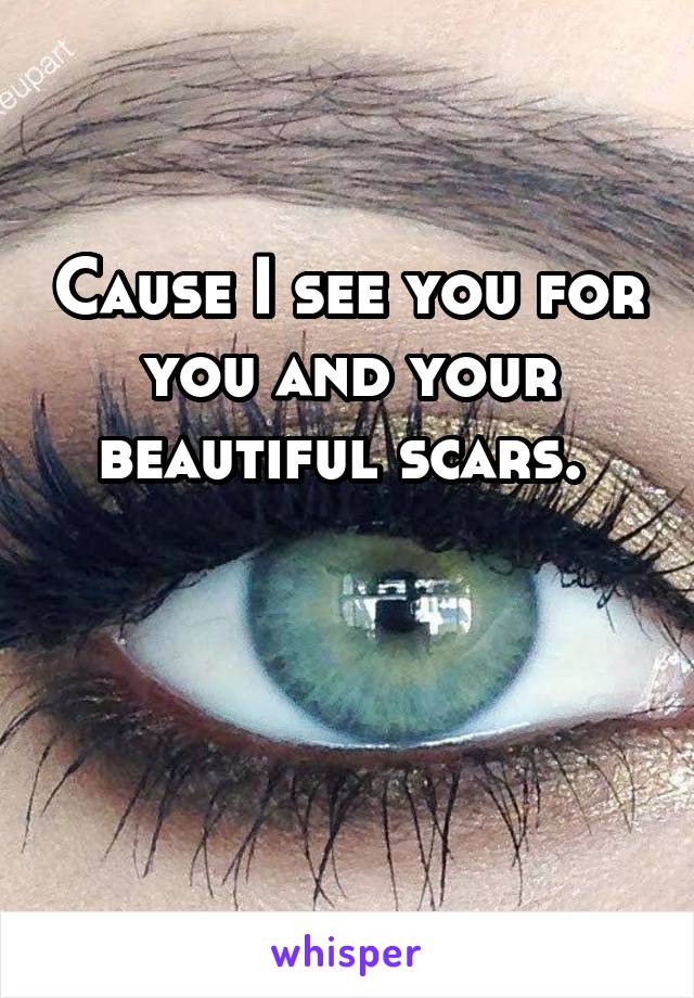 Cause I see you for you and your beautiful scars. 


