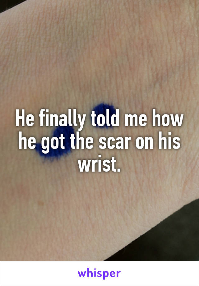 He finally told me how he got the scar on his wrist.