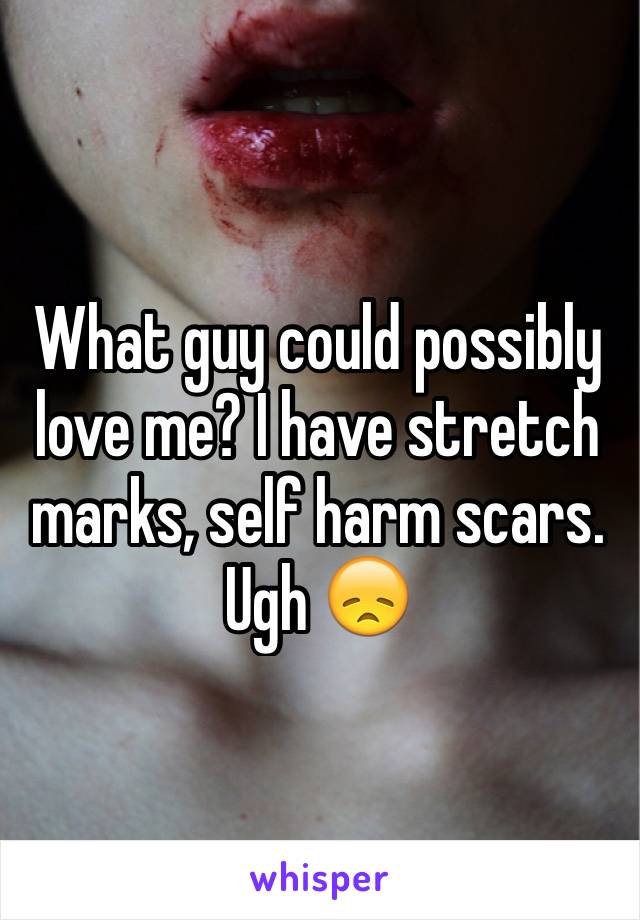 What guy could possibly love me? I have stretch marks, self harm scars. Ugh 😞