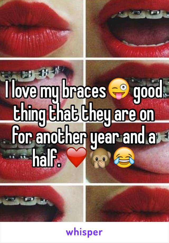 I love my braces😜 good thing that they are on for another year and a half. ❤️🙊😂