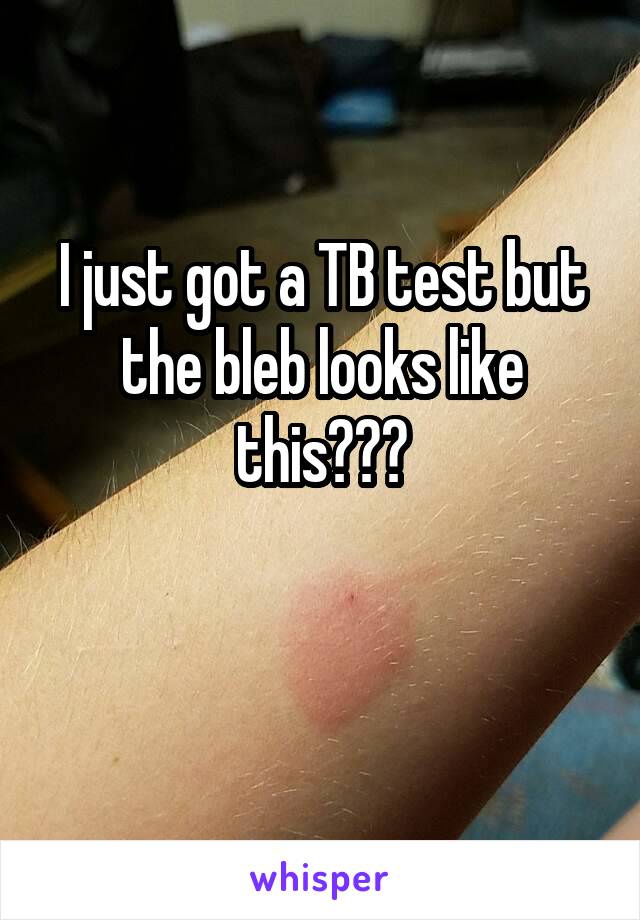 I just got a TB test but the bleb looks like this???

