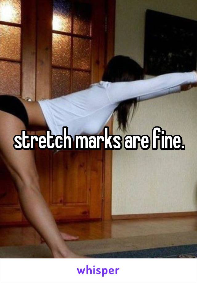 stretch marks are fine.