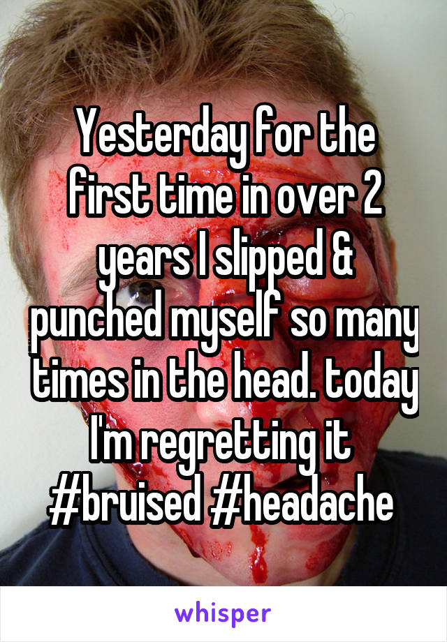 Yesterday for the first time in over 2 years I slipped & punched myself so many times in the head. today I'm regretting it 
#bruised #headache 