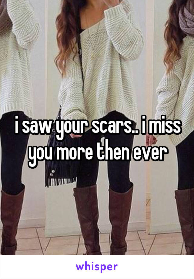 i saw your scars.. i miss you more then ever