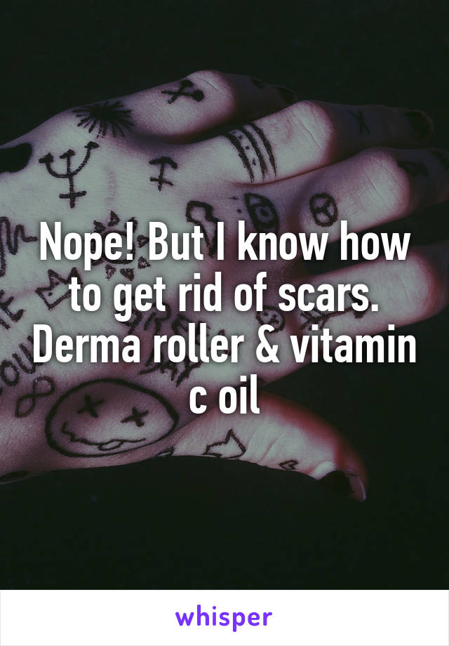 Nope! But I know how to get rid of scars. Derma roller & vitamin c oil