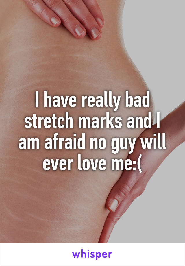 I have really bad stretch marks and I am afraid no guy will ever love me:(