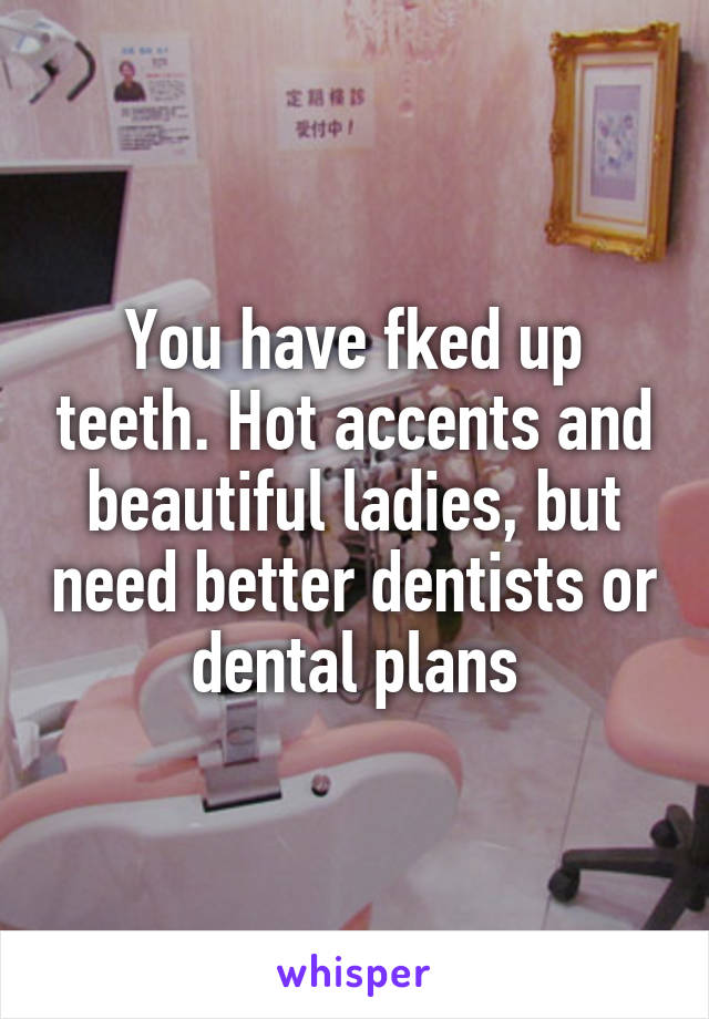 You have fked up teeth. Hot accents and beautiful ladies, but need better dentists or dental plans