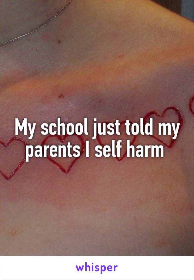 My school just told my parents I self harm 