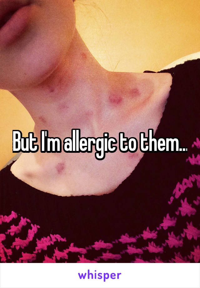 But I'm allergic to them...