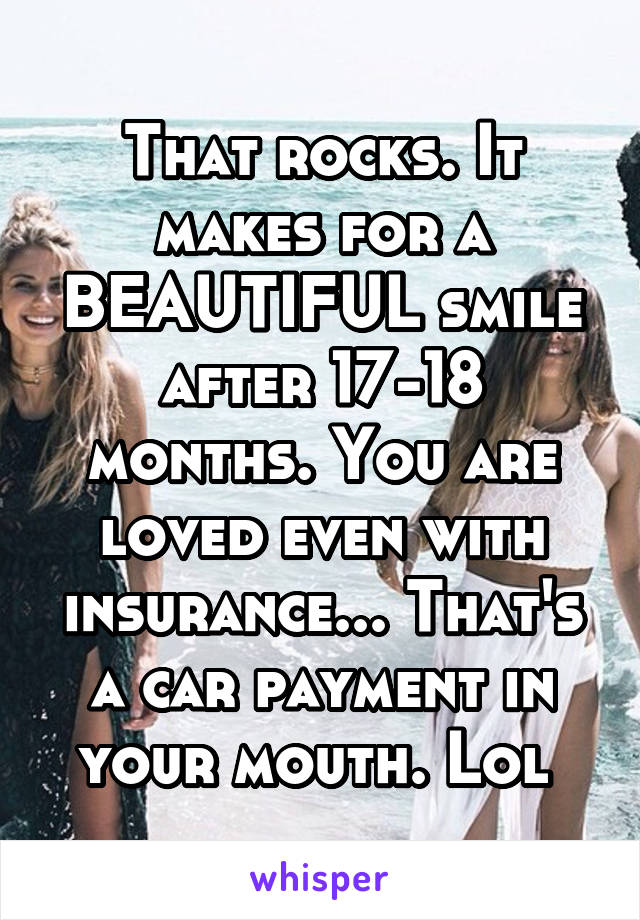 That rocks. It makes for a BEAUTIFUL smile after 17-18 months. You are loved even with insurance... That's a car payment in your mouth. Lol 