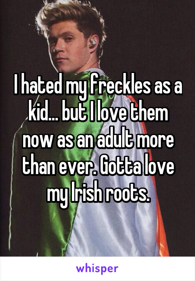 I hated my freckles as a kid... but I love them now as an adult more than ever. Gotta love my Irish roots.