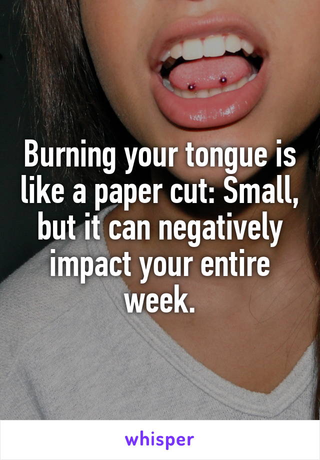 Burning your tongue is like a paper cut: Small, but it can negatively impact your entire week.