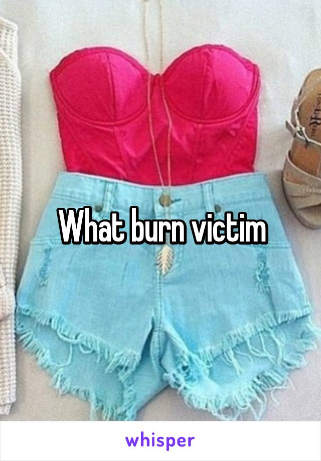 What burn victim