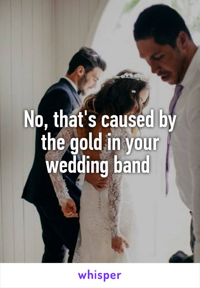 No, that's caused by the gold in your wedding band 