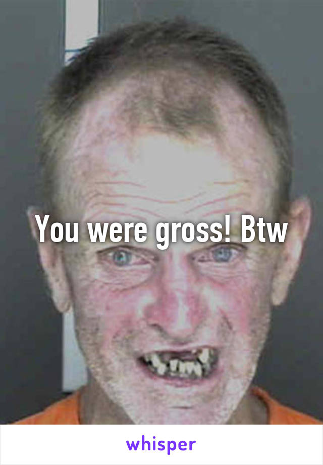 You were gross! Btw