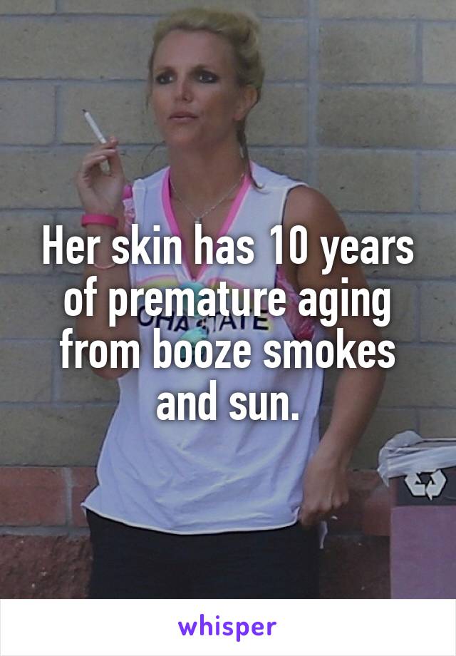 Her skin has 10 years of premature aging from booze smokes and sun.