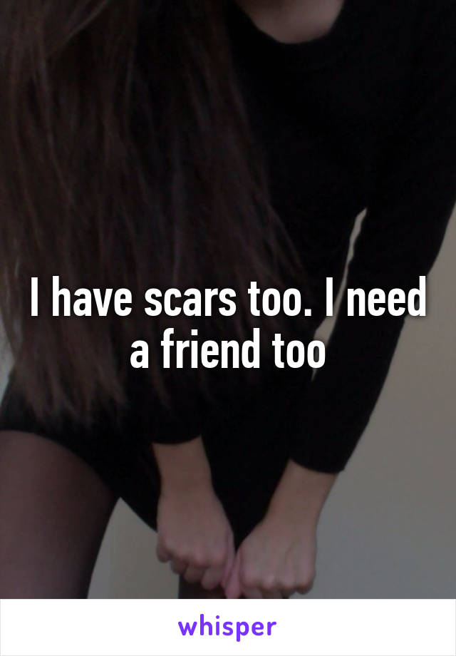 I have scars too. I need a friend too