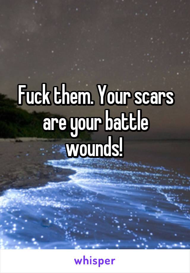 Fuck them. Your scars are your battle wounds! 
