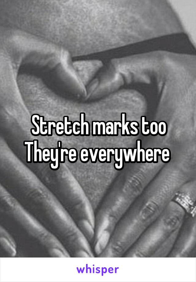 Stretch marks too
They're everywhere 