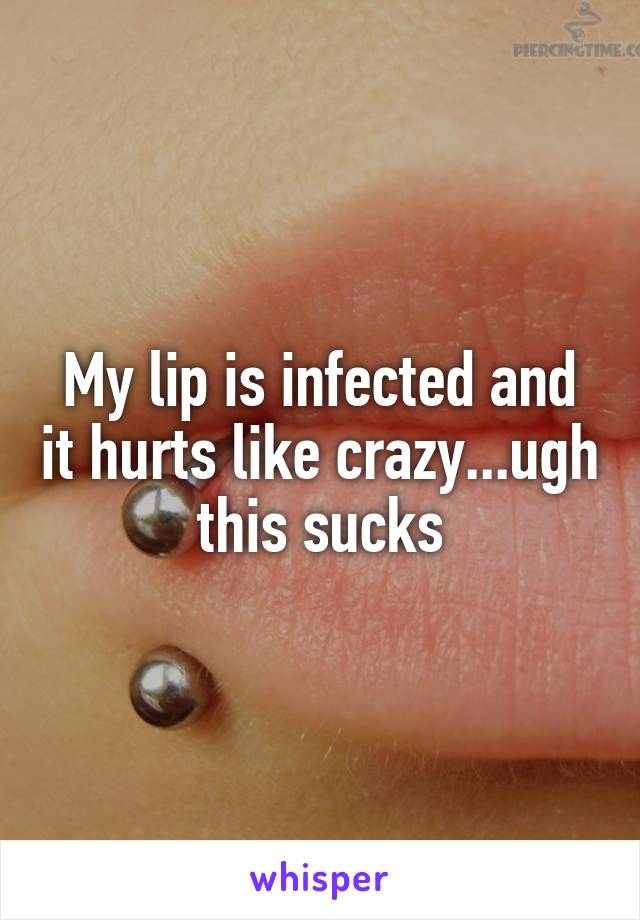 My lip is infected and it hurts like crazy...ugh this sucks