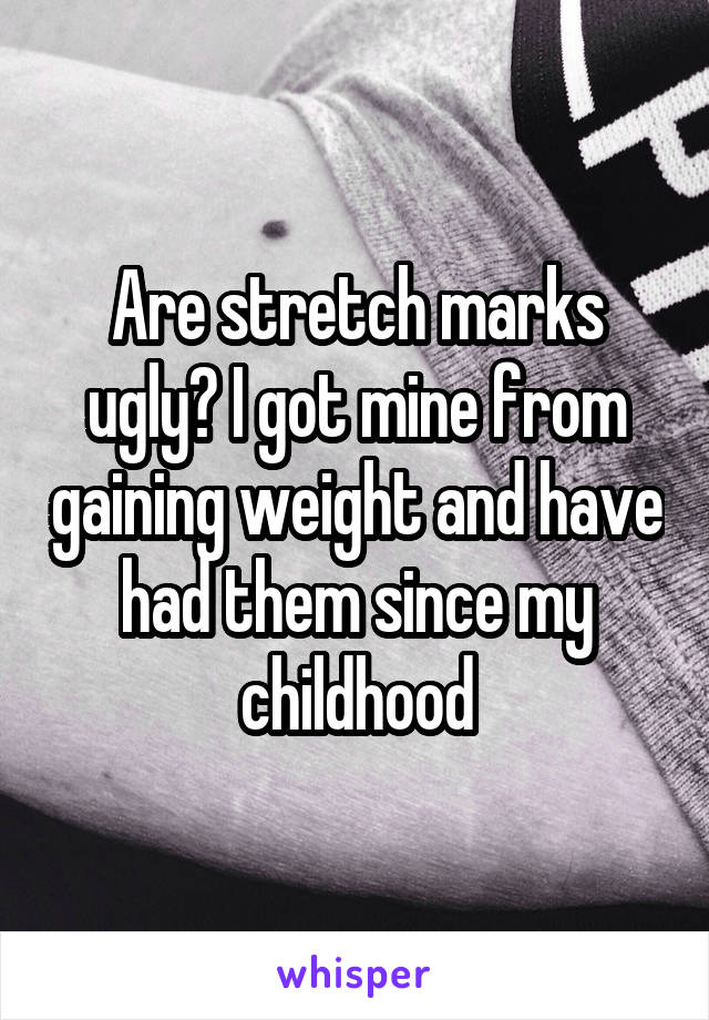 Are stretch marks ugly? I got mine from gaining weight and have had them since my childhood