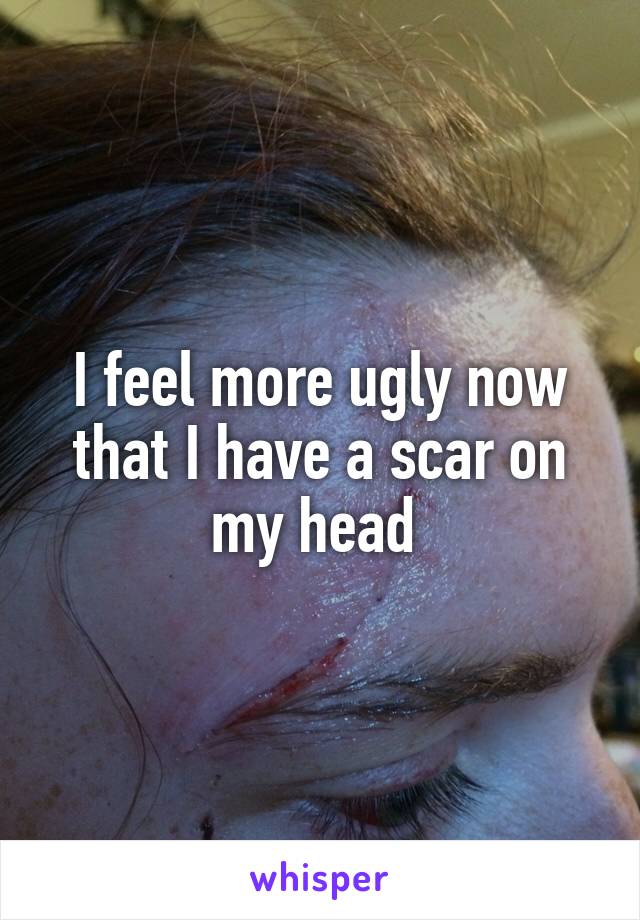 I feel more ugly now that I have a scar on my head 