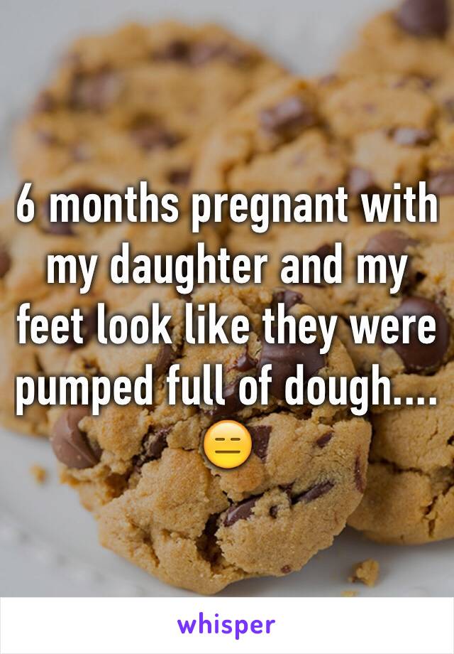 6 months pregnant with my daughter and my feet look like they were pumped full of dough.... 😑