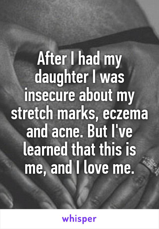 After I had my daughter I was insecure about my stretch marks, eczema and acne. But I've learned that this is me, and I love me.